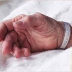 A patient's hand